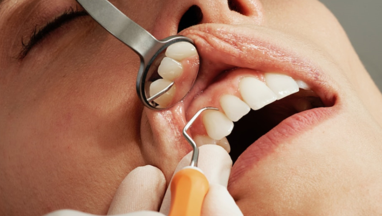 Kiedy należy wybrać się do dentysty?