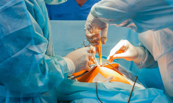 laparoskopia ginekologiczna